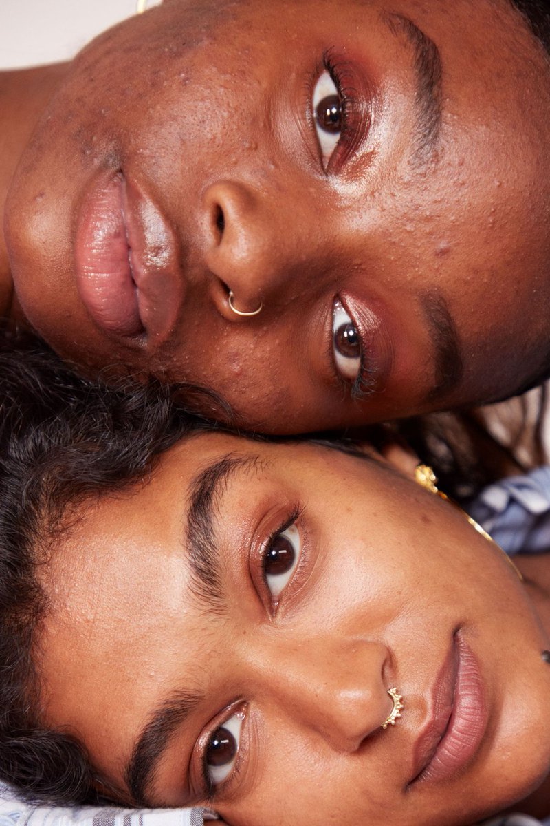 So what is hyperpigmentation? It can look like little dark marks, diffuse discoloration, or darker patchy areas. There are different types of hyp., but 2 that POC and more specifically WOC are more prone to are post-inflammatory hyp. (PIH) & melasma. What kind(s) do you have?