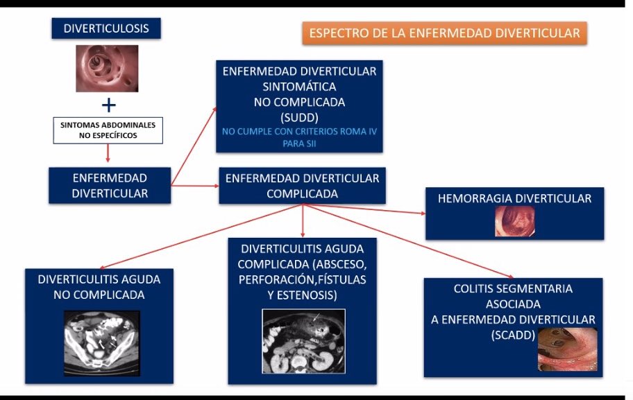 Gastrocivil's tweet photo. Agradecemos el compromiso y apoyo a la enseñanza de @ricardorana resolviendo grandes controversias acerca del manejo de la enfermedad diverticular. 

#MedTwitter 
#DistanceMedEd
@gastromx https://t.co/eII1aRt7im