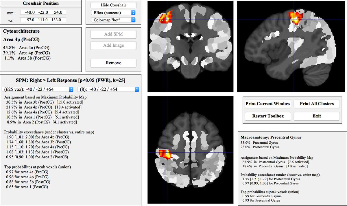 INM7_ISN's tweet image. Realized that the SPM Anatomy toolbox was published 15 years ago (May 2005: pubmed.ncbi.nlm.nih.gov/15850749)
➡️ That software aged better than me
⬇️ Time for a massive update: The beta-version of v3.0 can be found on our website (fzj.de/inm/inm-7/EN/R…), paper to come hopefully soon