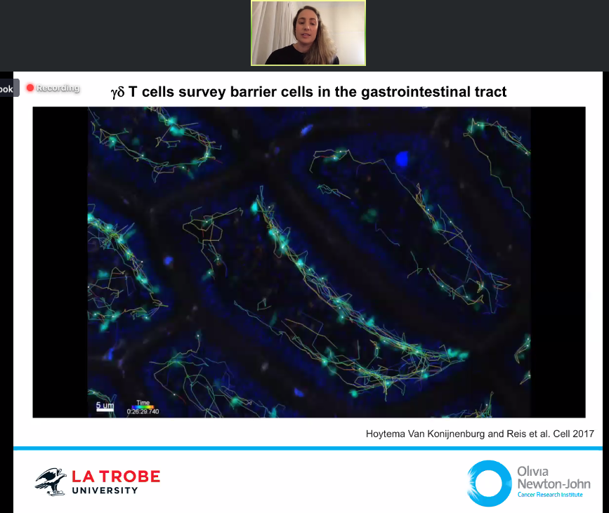 CatrionaNR's tweet photo. Our immune cells are powerful tools. @Mielke_Lisa @ONJCRI studies how they monitor and help fight #BowelCancer - and researches whether giving them a boost in combination with traditional #cancer treatments can enhance patient survival. @DayofImmunology #DoImmuno #immunotherapy https://t.co/v4wYSfPAsX