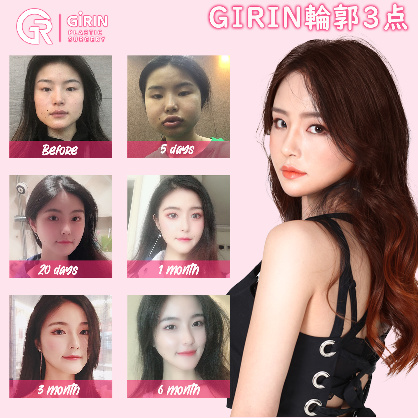 ささやき キッチン クレジット 韓国 Girin 美容 整形 外科 ジョージエリオット 更新する 一杯