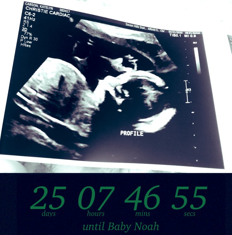 KKlayer's tweet image. 💚