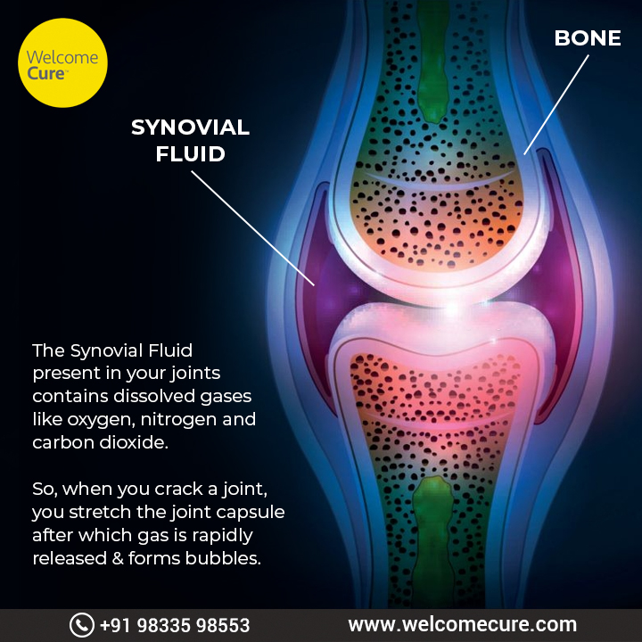 WelcomeCure's tweet photo. #DidYouKnow?
The sound from cracking knuckles comes from a specific gas accumulated in your joints 
#WelcomeCure#Natural #crackingknuckles #gasbubbles #knuckles #fact https://t.co/ycGeNNYiSS