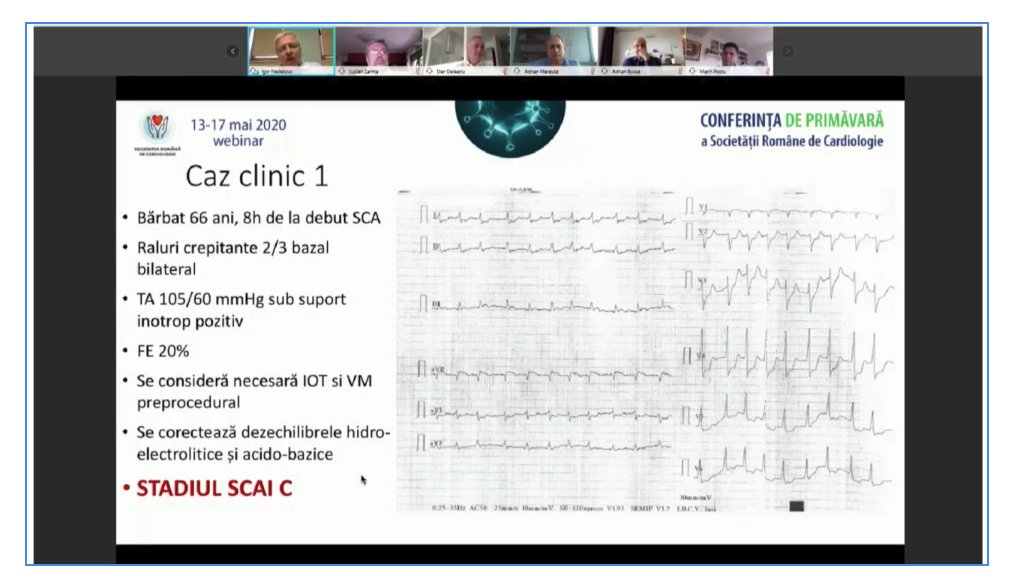 SRCCardio's tweet photo. INTERVENŢII CORONARIENE ÎN CIRCUMSTANŢE DEOSEBITE ~ Moderatori Dr. L. Zarma, Dr.A. Mereuţă~ Dr.A. Bucşa, Dr.D. Deleanu,Dr.I. Nedelciuc, Dr.M. Postu ~Conferinta de Primavara 2020 ~  https://t.co/Aoqh1enqyw ~ #CNP #GL2020 #ROCardio  
@ESCardioNews https://t.co/HaHaHI5DOm