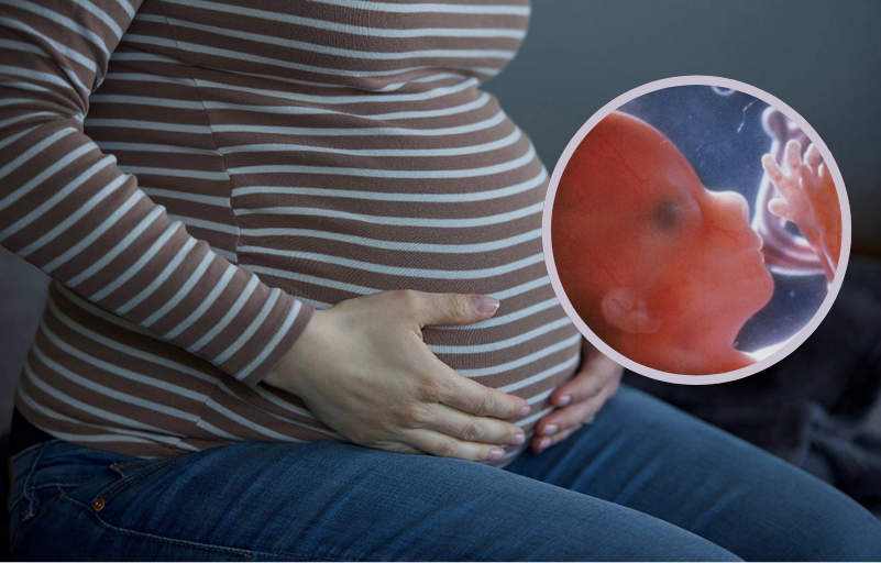 Chronicmeet's tweet photo. Fetal Alcohol Syndrome: Magnetic resonance images showed impairments to fetal brain growth during pregnancy due to alcohol consumption by the mother - https://t.co/n5LEiUKAMc

#chronicillness #COVID #pregnancy #imaging #researchers #healthcare https://t.co/ZBaHfN5RxX