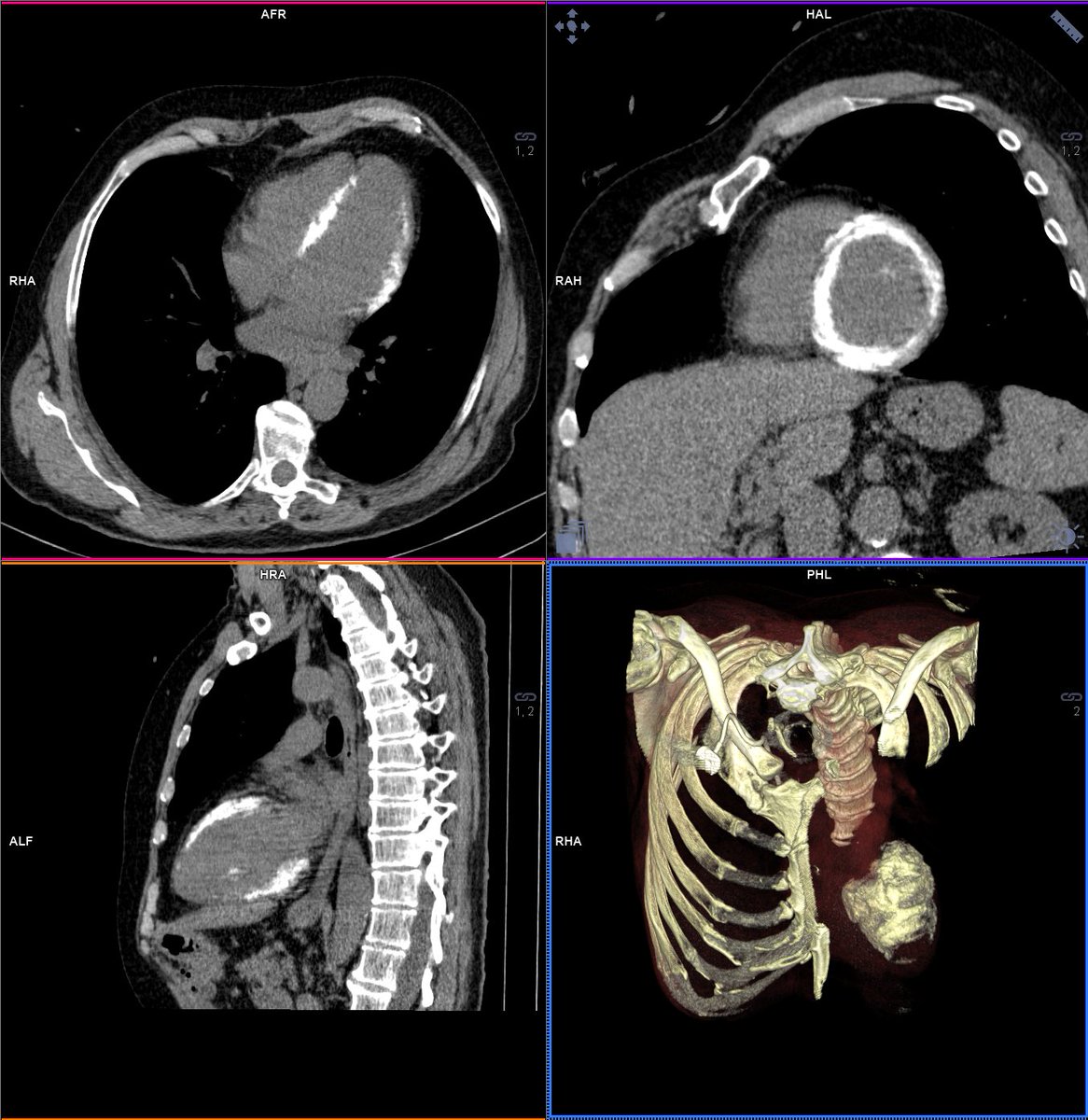 Daniel Lorenzatti, MD. tweet media