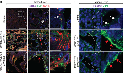 This study by Harish Palleti Janardhan, @trivedilab, et al. @UMassMedical @GSBS_UMassMed @vascularbiology demonstrates endothelial KRAS or BRAF gain-of-function mutations as a causal mechanism for hepatic vascular cavernomas bit.ly/3dIqnEY