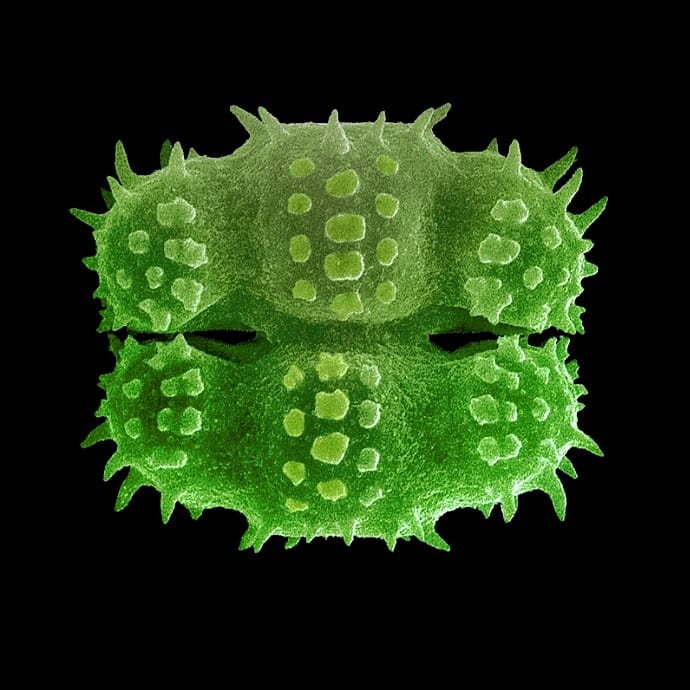 laficouefs's tweet photo. Algas da Bahia: Cosmarium lagoense var. amoebum
#algae #desmids #periphyton #desmidiaceae #cosmarium #freshwateralgae #botany #phycology #botany #limnology #phycologyfriday #scanningelectronmicroscopy #sem
https://t.co/7DqyZCCL7l https://t.co/JSpnNGQzzf
