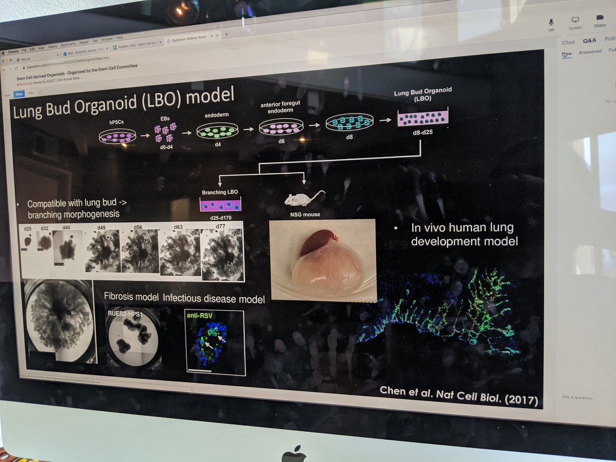 GiorgiaQuadrato's tweet photo. Ya-Wen Chen from @USCStemCell concluding with a fantastic talk the stem cell derived organoid session of #asgct2020. Happy for the opportunity to share the work of my lab alongside great speakers! https://t.co/zWyOqGr6Io