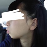歯列矯正したら横顔も美しくなれる!？