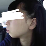 歯列矯正したら横顔も美しくなれる!？