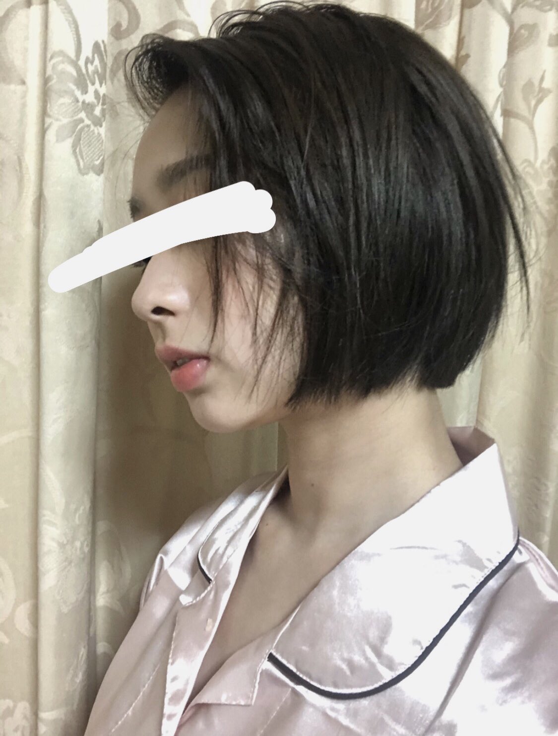 美容ちゃん 歯列矯正だけひょっとこみたいな横顔から抜け出せた例です 1枚目が高1くらいで2枚目が今 両方ノーマルカメラで目隠し以外加工してません 恥ずかしいけど誰かの参考になれば嬉しい 歯列矯正 T Co Hlq5n8bg2a Twitter