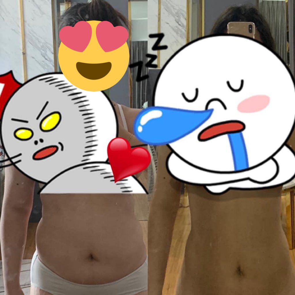 mimilkss's tweet photo. " การลดน้ำหนัก...
ที่พึ่งแค่เวลาว่างและวินัยของตัวเอง "

กับการหายไป 16kg. เกือบ 3 เดือน✌🏻
มันทำให้รู้ว่าไขมันที่แม่งไปซ่อนอยู่ที่ขา,แขนและพุงมันเยอะมาก และใช่การลดน้ำหนักได้ไวไม่จำเป็นต้องพึ่งยาลดน้ำหนักที่ไปกดประสาทการหิวของเรา แต่เราทำแค่การออกกำลังกายและควบคุมอาหารเท่านั้น💪🏻 https://t.co/GKkeDAtmdG