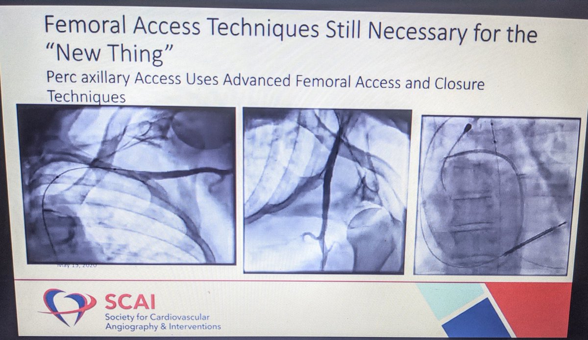 aayshacader's tweet photo. #SCAI2020 @SCAI
@duanepinto debates: learn good #safefemoral
๐ธ Application of access skills situational
๐ธ Versatility๐
๐ธnot just #safefemoral: #axillary access: #Radialsecond ?
@djc795 @fjsawaya @FaroucJaffer @rashaalbawardy @ShaziaTHussain1 @TomJFord @CardiacJoshi @Tabaza https://t.co/3teMbRIryf