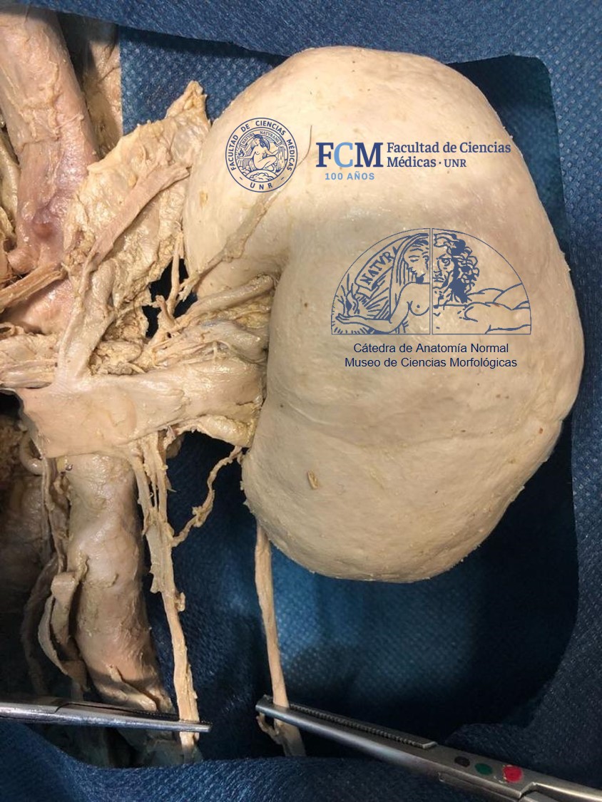 anatomiafcmunr's tweet photo. 💀DISECCIÓN CADAVÉRICA ‼️ Se visualizan riñones con uréteres, glándulas suprarrenales, vena cava inferior y aorta abdominal. Gran trabajo de nuestro equipo del Museo💀 https://t.co/ainrZDTRBQ