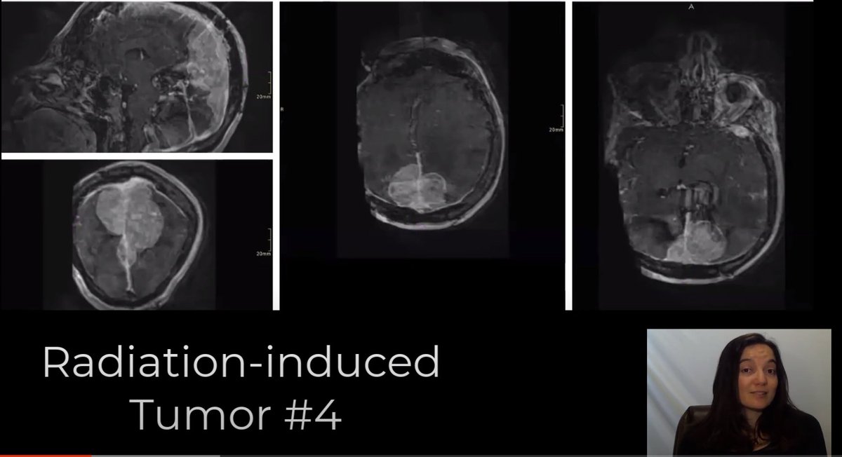 Adventures in Neuropathology tweet media
