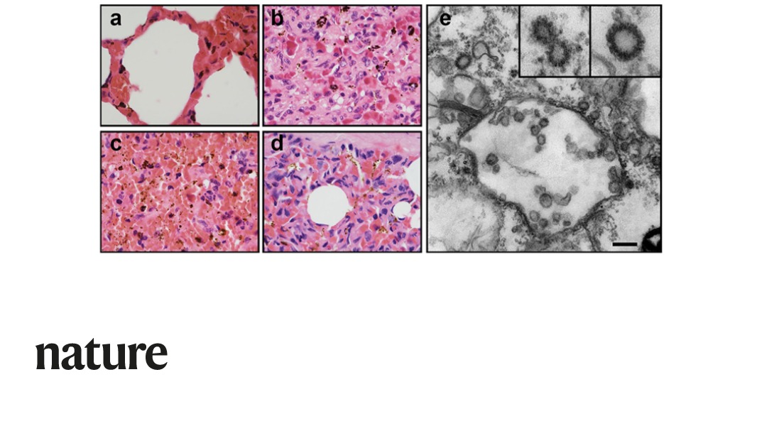 A Nature paper suggests pangolins have the potential to act as the intermediate host of  SARS-CoV-2. The paper reports the virus in the most-trafficked mammal could represent a future threat to public health if the wildlife trade is not controlled. go.nature.com/3fE4oks