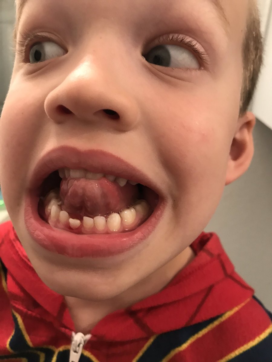 JakeRsmith10's tweet photo. Coaches Corner turned Barber ship to a dentist office tonight! #JackBoyz #1stTooth https://t.co/wUrIXoxwue