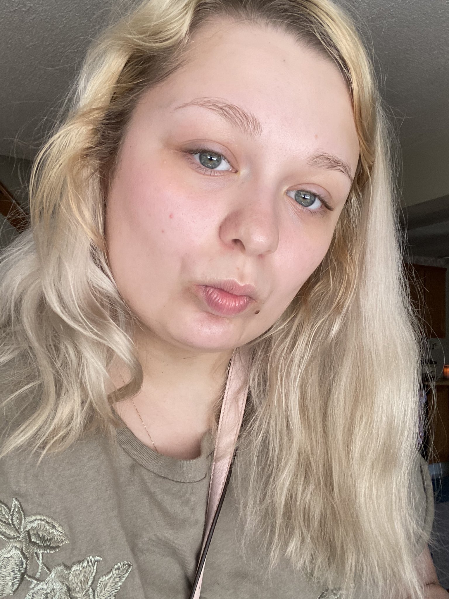 mckayla-on-twitter-sooo-my-skin-is-getting-better-this-is-march