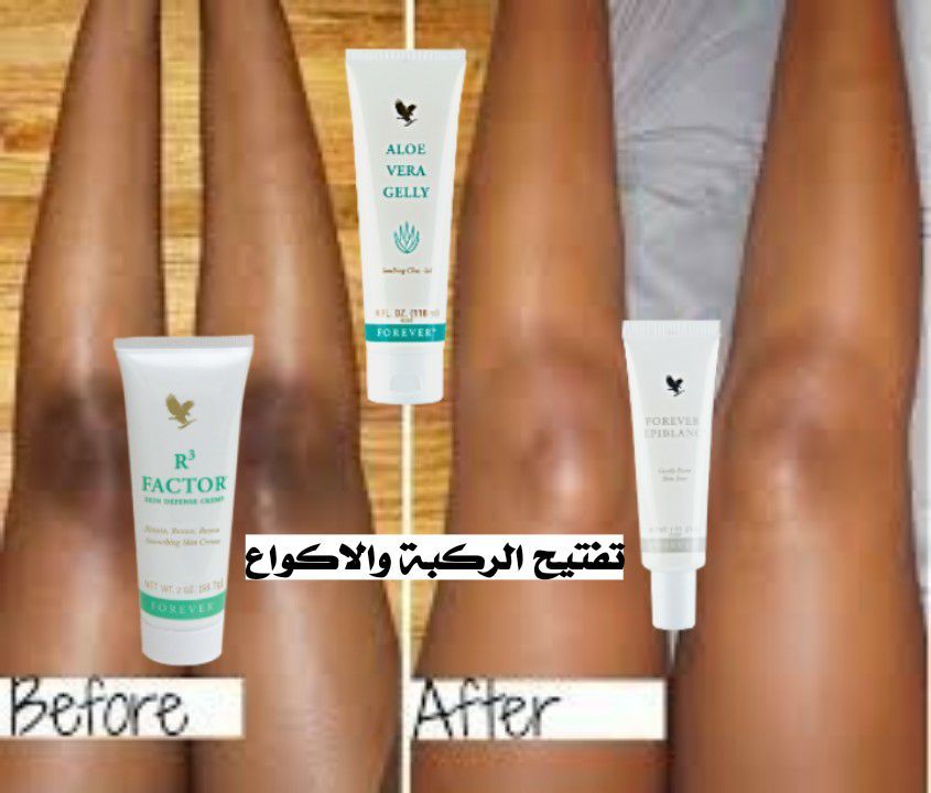 مجموعة تفتيح الركبه والاكواع 🌵🍋
يتكون من 3 كريماات 
بقولكم عنها بالبوست 👇
#دعم_صوالين_التجميل
#دعم_ح...