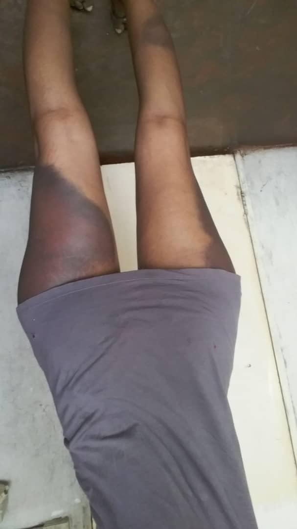 My African Pain tweet media