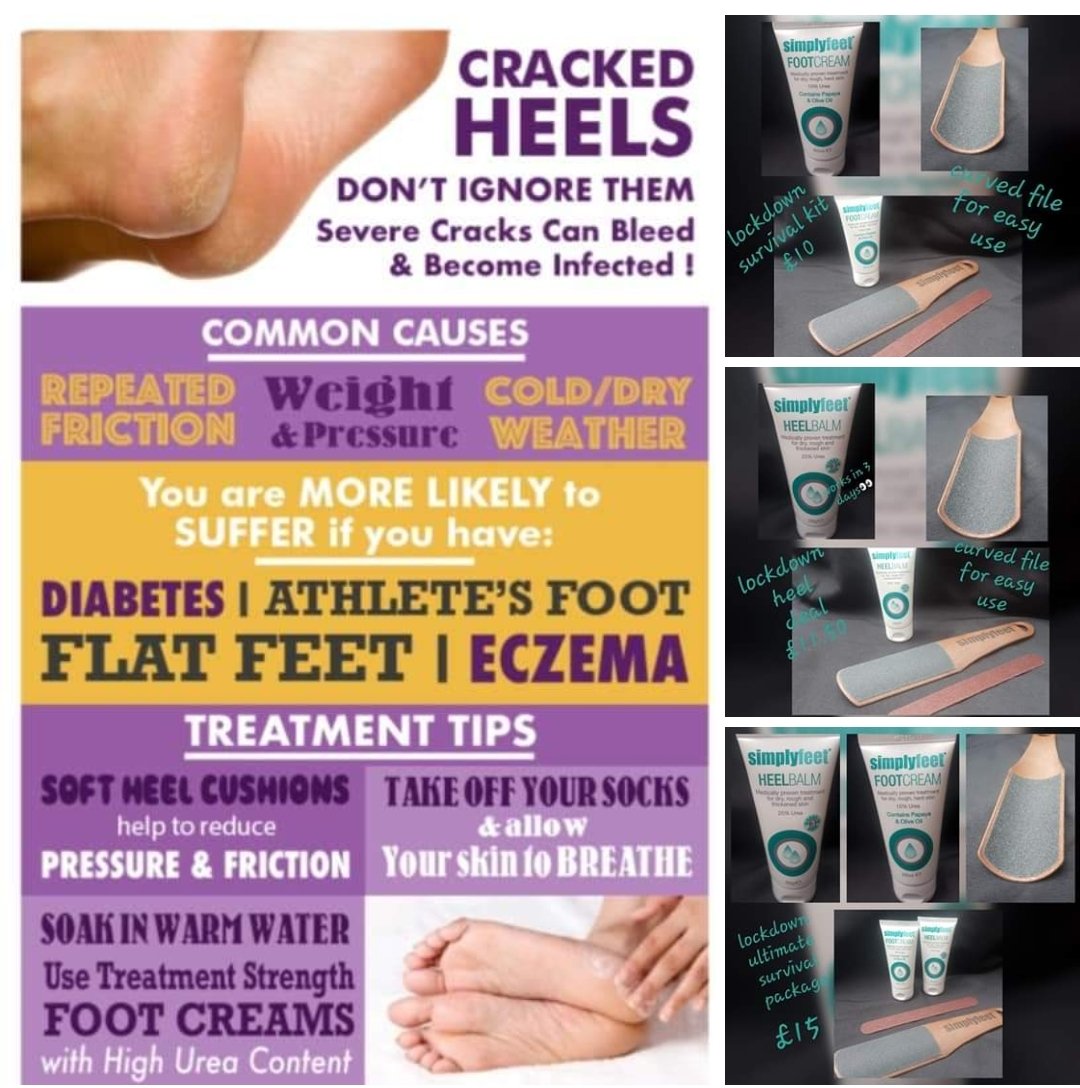 Bodyandsolecli1's tweet image. With lots of you doing more walking/jogging than ever 
Dont forget to look after your feet 👣
#foothealth
#Wolverhampton 
#bodyandsoleclinic
#makeadifferenceeveryday
#treatyourfeet
#healthyskin