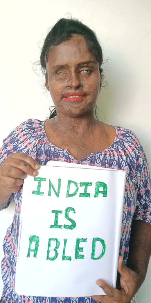 SheroesHangout's tweet photo. Please Do Support our petition ✌️📌 #Indiaisabled 
https://t.co/0xD2Ej1Co7 
We urge government to bring policies for those who have special needs like us, the acid attack survivors.

#Survivors #disabilityrights #help #DoSupport✌ #makeinability  #makesupportchain #sheroes https://t.co/MVmKDeEega