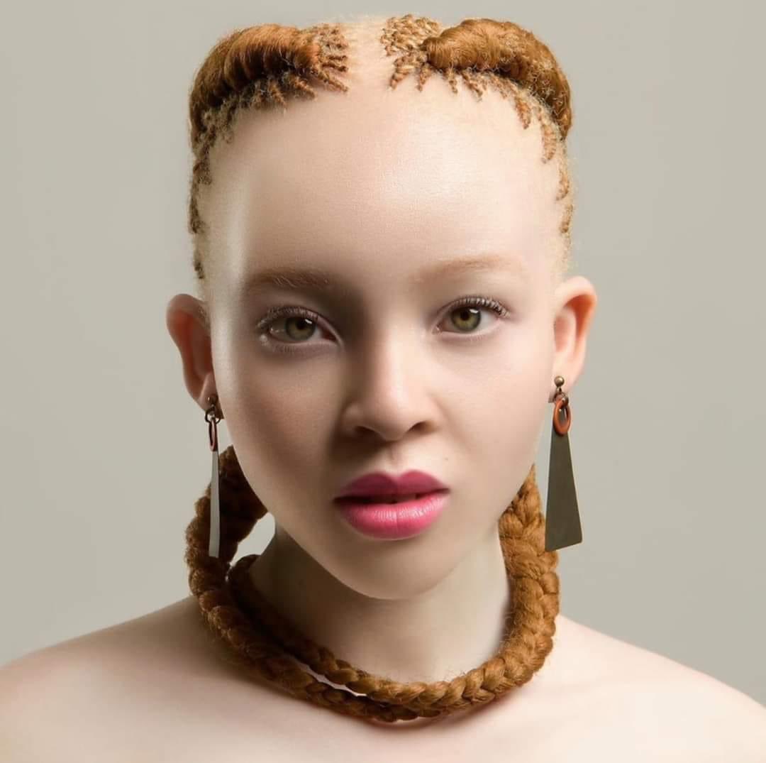 ManeerCeza's tweet photo. #IDontHaveTimeFor people who think albinism is not beauty 🤞🏽🤞🏽 https://t.co/EUhK9s48Ad