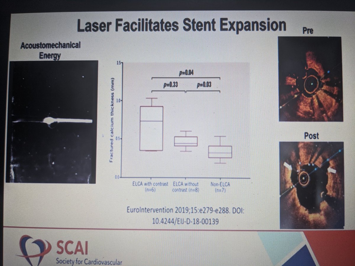 aayshacader's tweet photo. #SCAI2020 @SCAI
Complications 🔃 💉
@kevinjamescroce stent underexpansion  #ISR
🔸Imaging
🔸LASER w contrast
🔸Rota: ablates stent strut
🔸Orbital atherectomy
🔸IVL

@CaraCarahendry @sbrugaletta @HanCardiomd @HadyLichaaMD @DrJayMohan @UjjwalRastogiMD @ZeroTLR @aspergian1 @Tabaza https://t.co/ocu3qHXWUT
