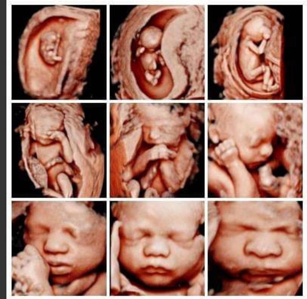 babystudioseq's tweet image. See your baby grow, from 9 weeks all the way to 38 weeks. It's so amazing to see their development and those awesome chubby cheeks towards the final weeks,
Call 0455554420 to book or book online babyultrasoundstudio.com.au

#bestultrasoundstudio #3dbabyscan #sunshinecoast
