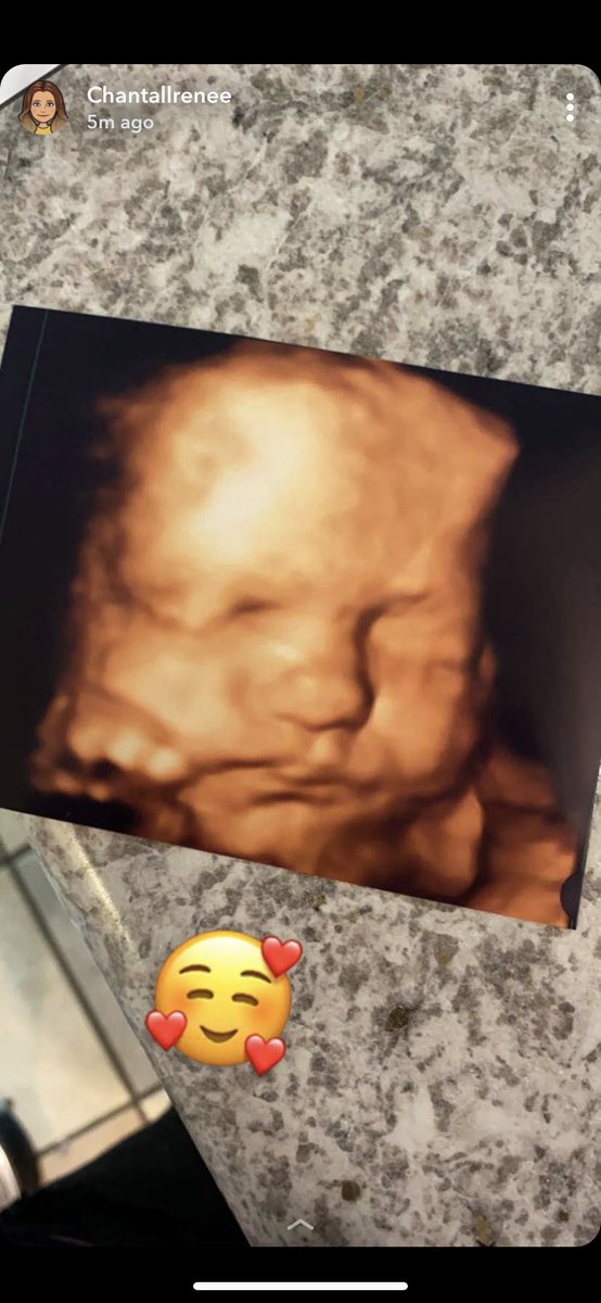 Chantall_Renee's tweet photo. Baby boy getting nice and thick🙈 https://t.co/NztmEihpCV