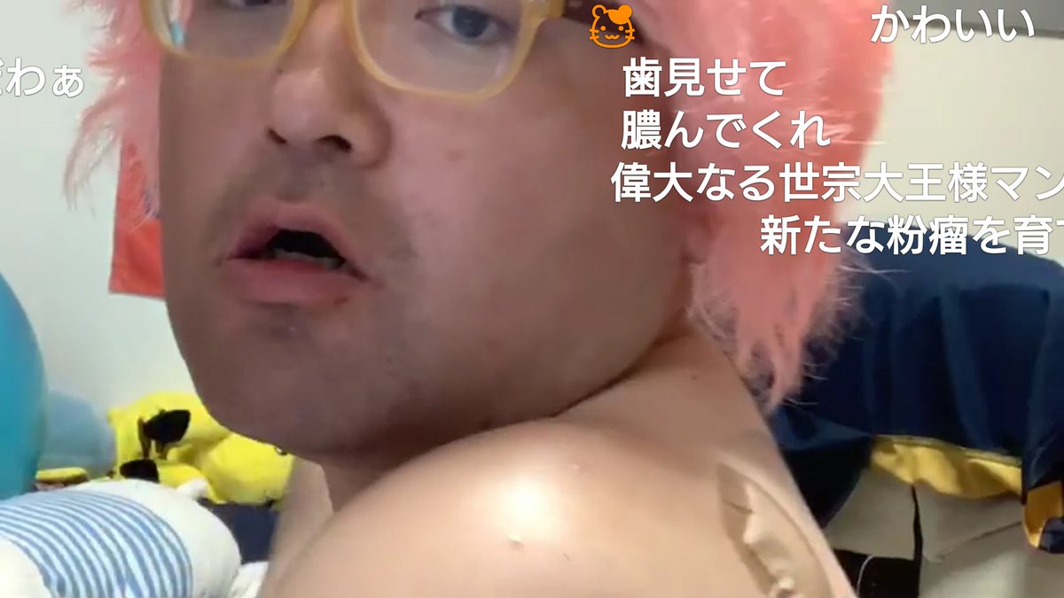 人力知能 野田草履ｐ 粉瘤手術後画像 あまりあがってないので野田草履がニコ生で虫歯と粉瘤の縫い跡を見せびらかしてた時に保存してた画像をツイートしてみます 問題あれば削除します Nodasori2525 ニコニコ生放送 野田草履p 野田草履過去画像は