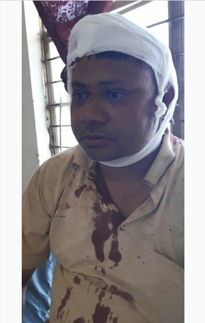 TetPrasad's tweet photo. गया जिले के इमामगंज प्रखंड मे कोरोन्टाईन सेन्टर पर प्रवासीयों द्वारा शिक्षको पर हमला कर घायल कर दिया गया
आत्मा भी मर गयी है क्या c.m साहब जमीर के साथ साथ
न तो सुरक्षा
न सुरक्षा उपकरण
न बीमा
न भत्ता
क्या इसी लायक है कोरोना वारियर्स
@CMNitishKumar
@yadavtejashwi 
@pappuyadavjapl https://t.co/MJEaDu1efG