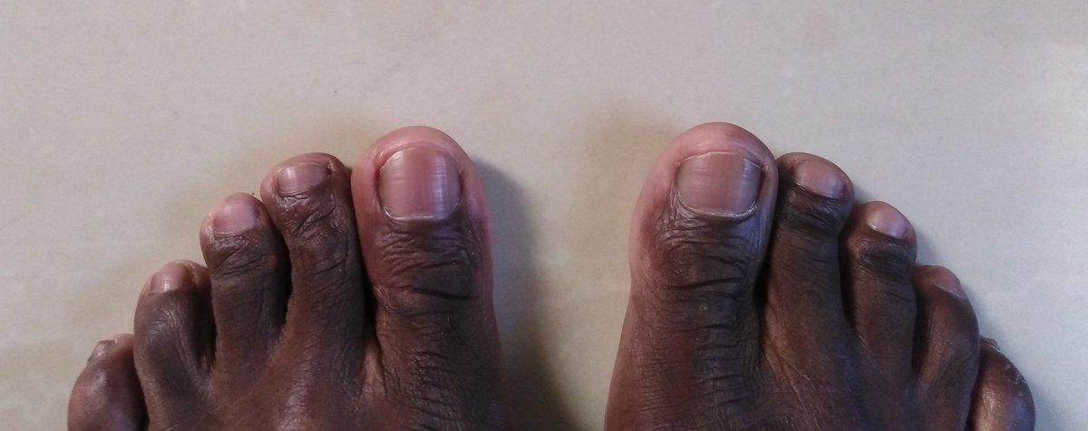 NjomaneWMV's tweet photo. I challenge you to show me your toes, I promise even if I have to laugh i will not laugh. Promise 🤞🏾😅 #ToesChallange https://t.co/fVl1flVpCX
