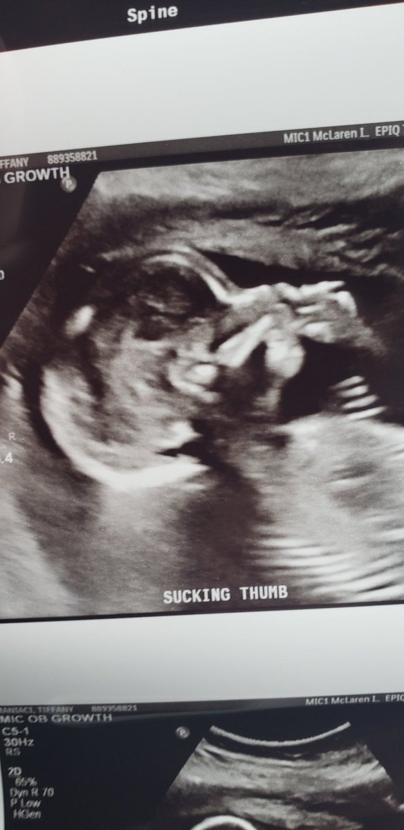 Oh_Sister's tweet photo. @danielle9266 Girl, isn't it amazing? Are you finding out the sex? At my 20 week scan, I found out I'm having a girl and she was sucking her thumb. My heart is so full and I love her more than anything I've ever known. https://t.co/GTVimcLUAt