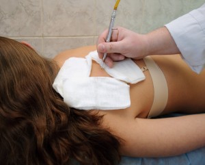 howmuchcostisit's tweet photo. Cost of Remove Mole.
There are three main methods which can be used to remove a mole are Surgical, laser, Freezing.
Regardless of these factors the average price we have found it to be ranges between $100 and $60.

https://t.co/v7w0zt1wTX

@TheDermEditor 
@AADmember 
@DermMN https://t.co/8owOGj6moJ
