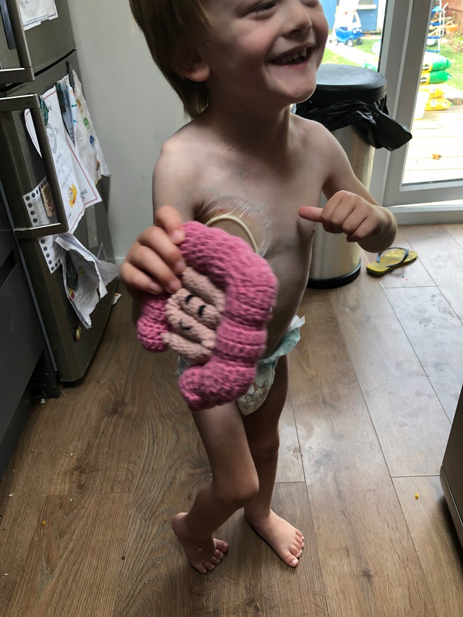 NECUK_Charity's tweet photo. Reality of NEC!
@NECsociety @institutopgg @EvaRoseTrust @GutsCharityUK @NeoResearch_Net @AllianceNec @SurvivingNEC @LakeviaWard @CJStewart7 @ccroehr @EFCNIwecare https://t.co/RQ2jfkvGCc