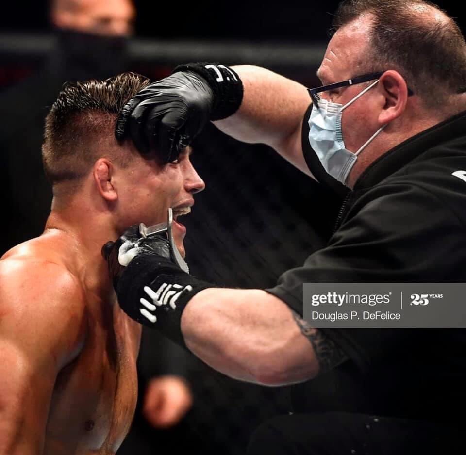EmpireProTape's tweet photo. UFC veteran cutman @boston_strong_cutman_ putting the @empire_protape Pro Curve Endswell through its paces last night #ufc #empirepro #endswell #trustedbrand #elitelevel #cutmanessentials #empireprotape #thetapeofchampions #thetapeofthefightgame #thebestusethebest https://t.co/YpCCumcSdf
