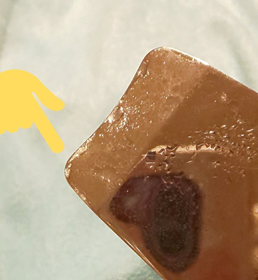 角 栓 取れ ない コメド 角栓 を押し出す のはダメじゃない 巷の間違いケアを皮膚科医が指摘