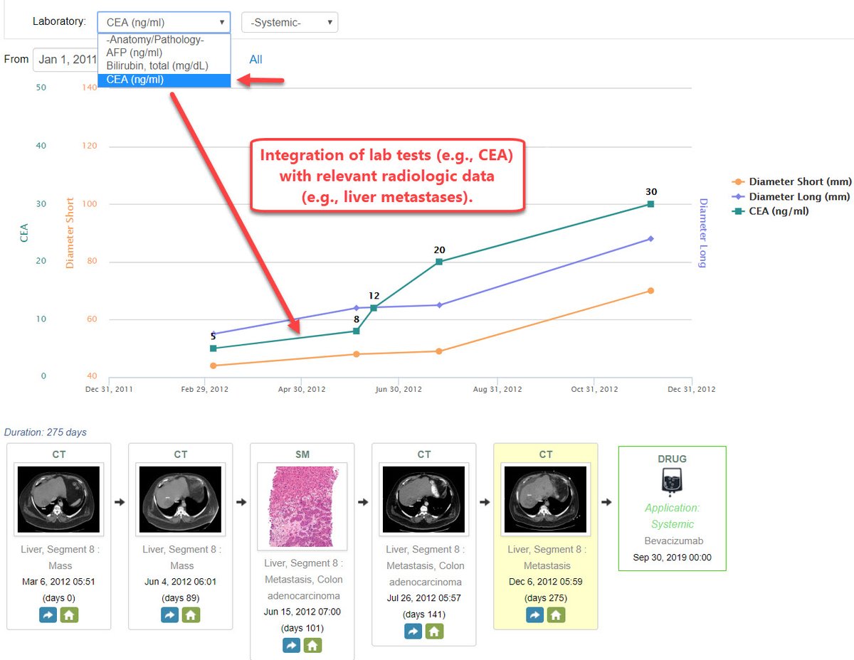 David J. Vining, MD (@visionsr) on Twitter photo Structured reporting incorporating a multidisciplinary ontology is key for connecting medical information. This allows for laboratory tests relevant to specific radiological findings to be integrated with pathology and treatments in disease timelines. <a href="/RSNA/">RSNA</a> <a href="/RadiologyACR/">American College of Radiology</a> <a href="/ASCO/">ASCO</a> Structured reporting incorporating a multidisciplinary ontology is key for connecting medical information. This allows for laboratory tests relevant to specific radiological findings to be integrated with pathology and treatments in disease timelines. <a href="/RSNA/">RSNA</a> <a href="/RadiologyACR/">American College of Radiology</a> <a href="/ASCO/">ASCO</a>