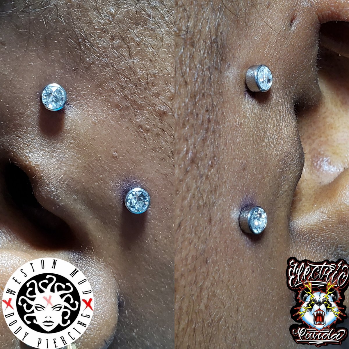 WestonMod's tweet image. Surface bar outside of tragus.
#westonmod