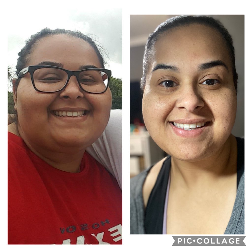 Martita_DeLeon's tweet image. 18 months out, 180lbs down and 90lbs to go... progress, not perfection❤️ #TrueLoveStarts #ByLovingYourselfFirst  #Idoitforme