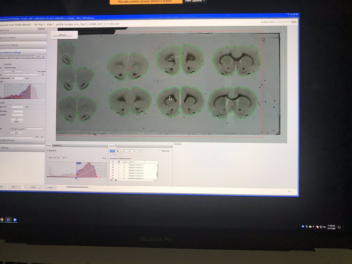 Remotely assisting a thrilled GS in her final months on a Sunday morning after the AxioScan has been down for several months is the JOY I needed. The new computer is lovely. The software version it supports is smarter than the one I’d been using. This is doable! @BerkeleyMIC