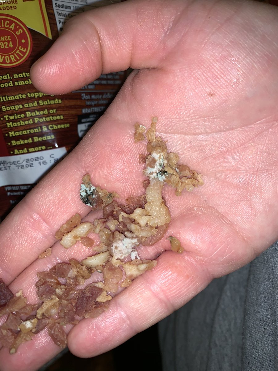 katiegawlak's tweet photo. Just bought these bacon bits to make pizza tonight and found a ton of mold in the bag when I dumbed it out. DISGUSTING 🤢. @oscarmayer https://t.co/5CU6yLlW9W