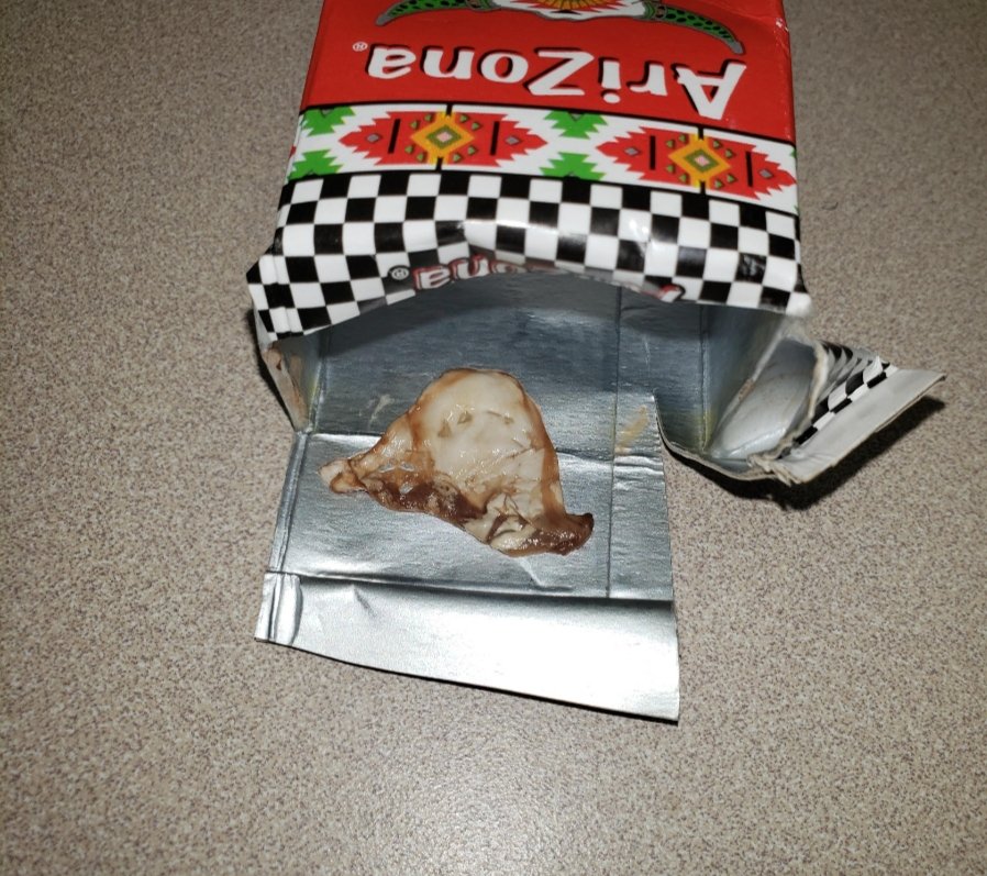 ExodusLynnette's tweet photo. @DrinkAriZona sooooo, what should I do about this body tissue-like membrane I found in my juicebox that literally made me sick? What was this? https://t.co/ibwYGl8NjN