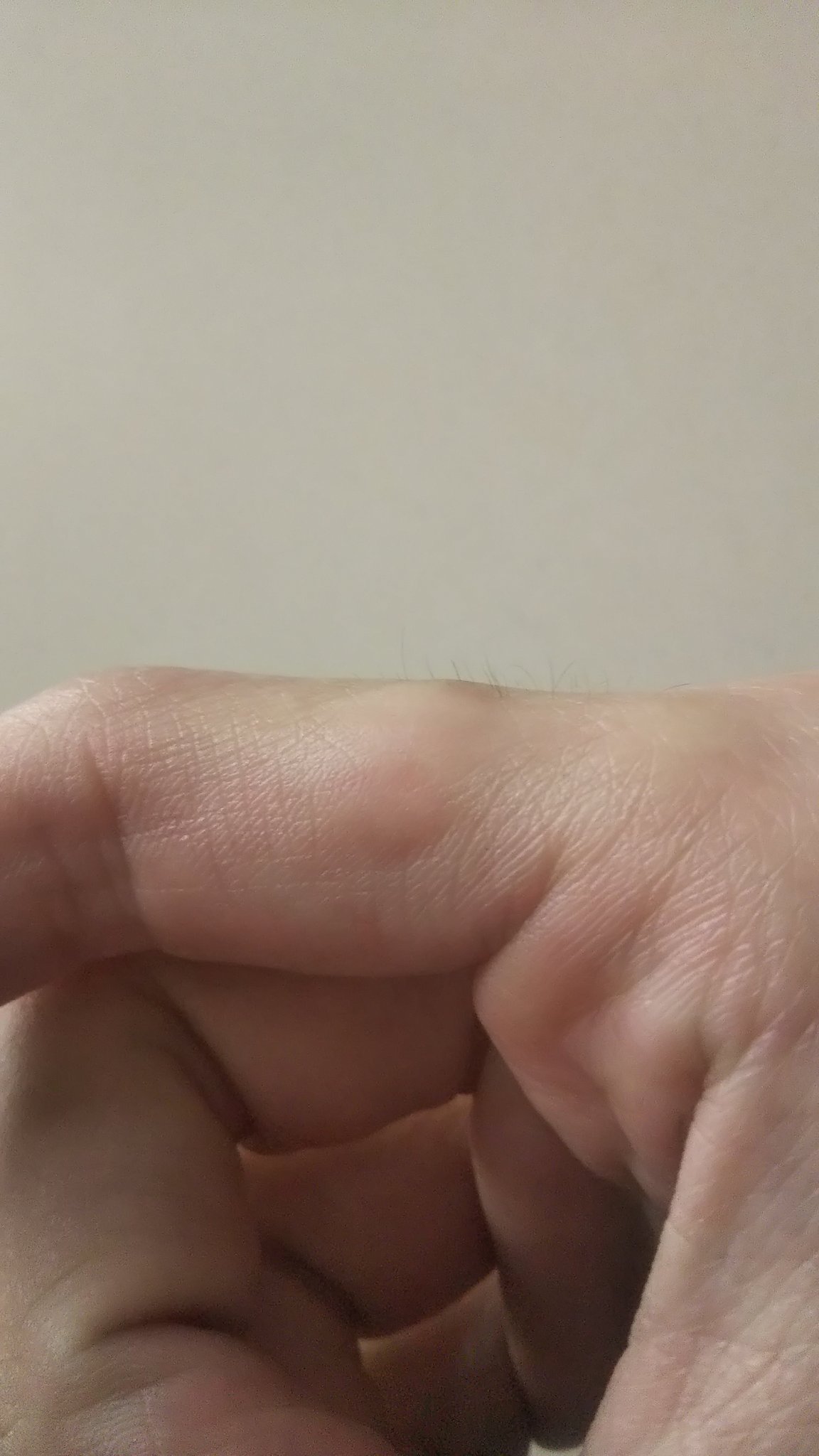 تويتر このアカウントは使用していません على تويتر 指を噛む癖をどうにかしたいと思う今日この頃 食いちぎられまいと皮膚が強化されまくって超硬くなった T Co 3ua3q8njnf