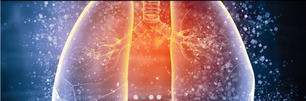 SLEEP DISORDERS IN NEUROMUSCULAR DISEASES

Authors: Eric J Gartman

US Respiratory & Pulmonary Diseases. 2018;3(1):27–32 

Full free-to-access article available here: touchrespiratory.com/sleep-disorder…

#sleep #NeuromuscularDiseases