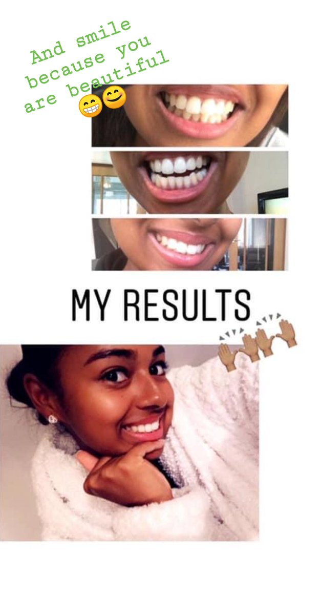 Portia_julesa's tweet image. Looking to brightens your teeth... We've got just the thing for you...
#BrighterSmiles
#FluorideToothpaste