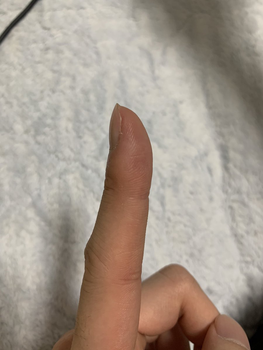 ট ইট র りたろ 指を立てて弾けないのが悩み 指先痩せすぎてて単に弾けないのか皮厚くなったら弾けるようになるのか分からない 教えてギター達者