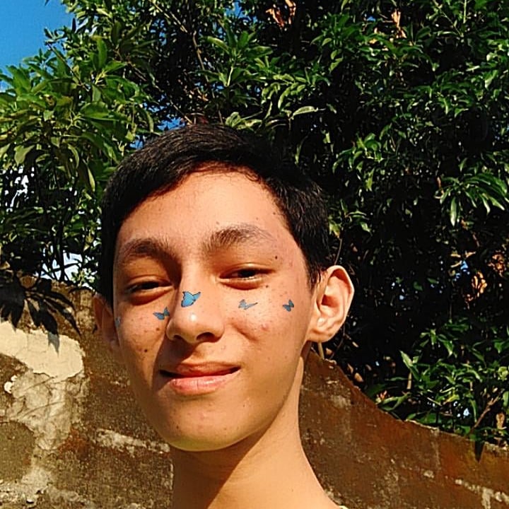 Hey_Jillian's tweet photo. My Pimple 🙄 https://t.co/dT3yU9eKf8